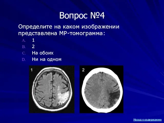 Вопрос №4 Определите на каком изображении представлена МР-томограмма: 1 2 На