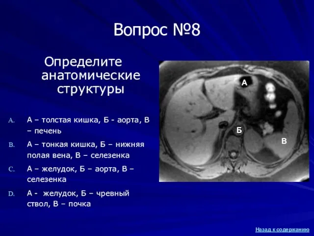 Вопрос №8 Определите анатомические структуры А – толстая кишка, Б -