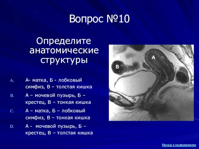 Вопрос №10 Определите анатомические структуры А- матка, Б - лобковый симфиз,