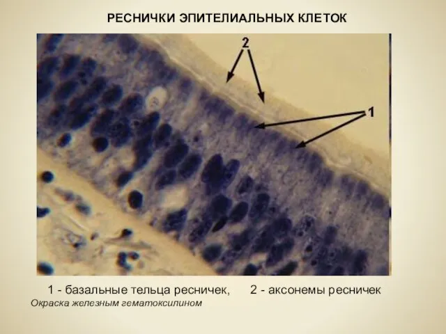 РЕСНИЧКИ ЭПИТЕЛИАЛЬНЫХ КЛЕТОК 1 - базальные тельца ресничек, 2 - аксонемы ресничек Окраска железным гематоксилином