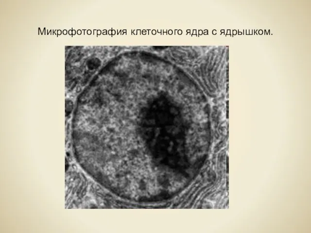 Микрофотография клеточного ядра с ядрышком.