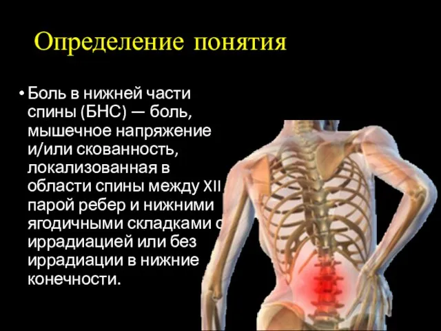 Определение понятия Боль в нижней части спины (БНС) — боль, мышечное