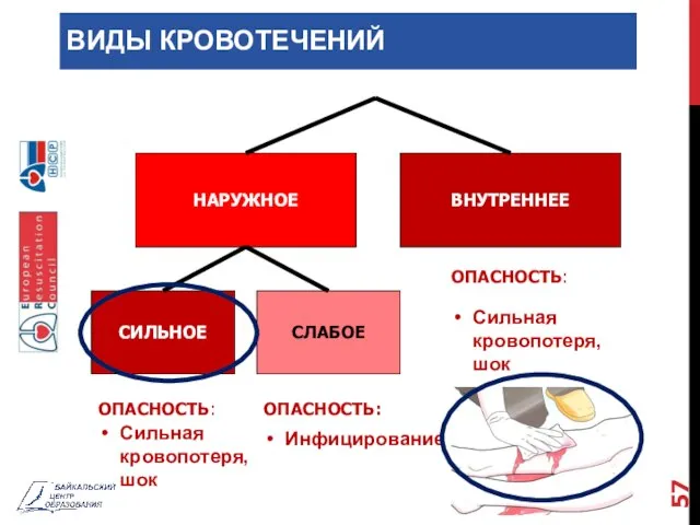 ВИДЫ КРОВОТЕЧЕНИЙ