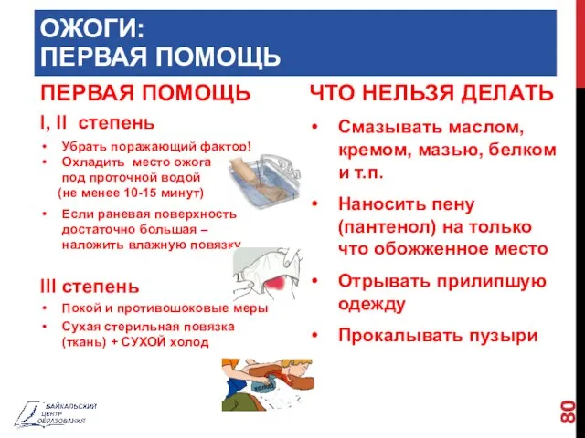 ОЖОГИ: ПЕРВАЯ ПОМОЩЬ ПЕРВАЯ ПОМОЩЬ I, II степень Убрать поражающий фактор!