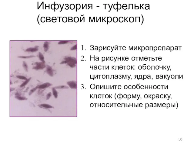 Инфузория - туфелька (световой микроскоп) Зарисуйте микропрепарат На рисунке отметьте части
