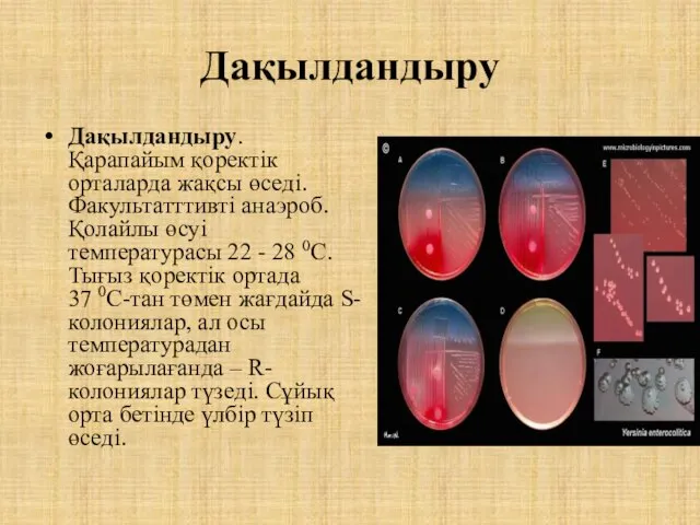 Дақылдандыру Дақылдандыру. Қарапайым қоректік орталарда жақсы өседі. Факультатттивті анаэроб. Қолайлы өсуі