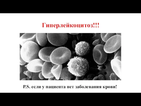 Гиперлейкоцитоз!!! P.S. если у пациента нет заболевания крови!