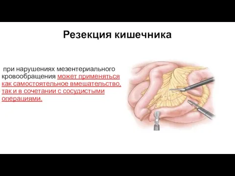 Резекция кишечника при нарушениях мезентериального кровообращения может применяться как самостоятельное вмешательство,