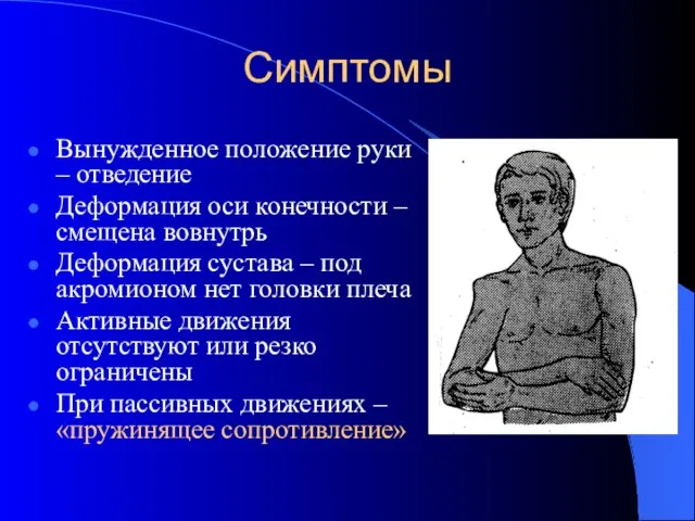 Симптомы Вынужденное положение руки – отведение Деформация оси конечности – смещена