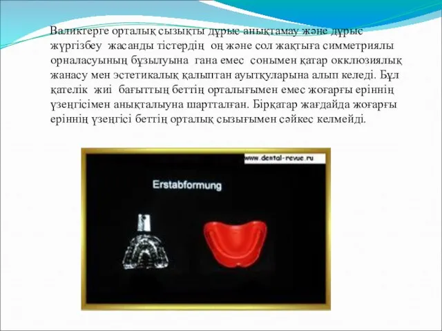 Валиктерге орталық сызықты дұрыс анықтамау және дұрыс жүргізбеу жасанды тістердің оң