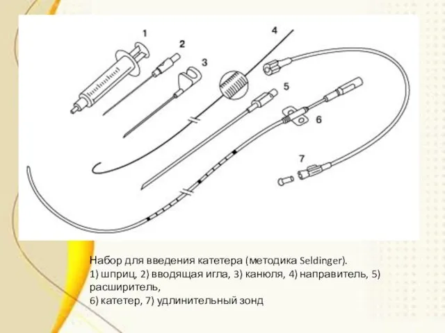 Набор для введения катетера (методика Seldinger). 1) шприц, 2) вводящая игла,