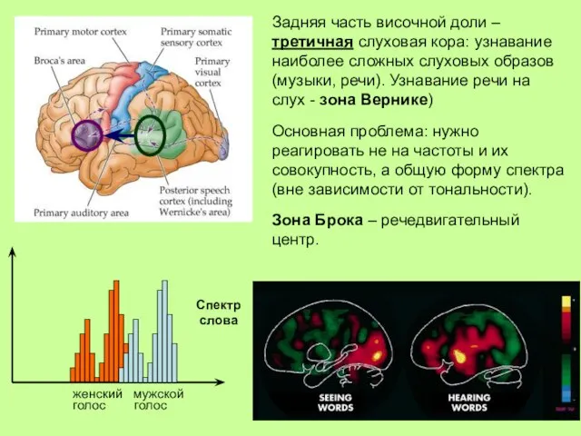 Задняя часть височной доли – третичная слуховая кора: узнавание наиболее сложных