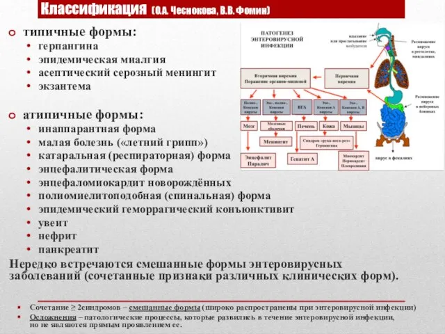 Классификация (О.А. Чеснокова, В.В. Фомин) типичные формы: герпангина эпидемическая миалгия асептический