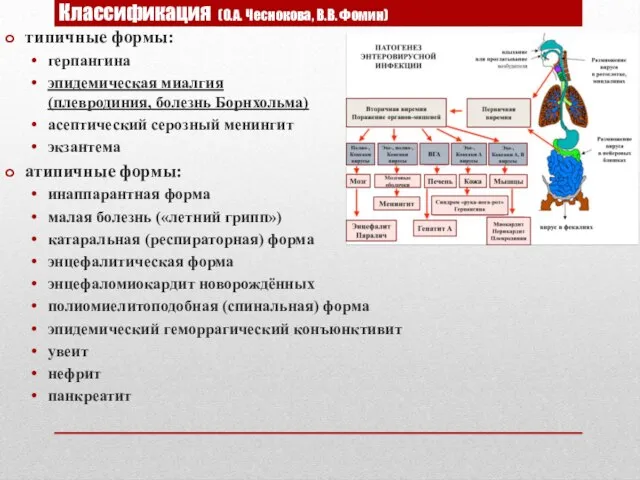 Классификация (О.А. Чеснокова, В.В. Фомин) типичные формы: герпангина эпидемическая миалгия (плевродиния,