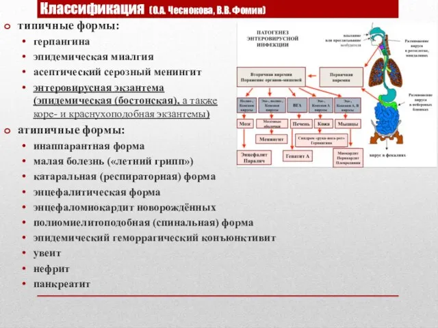 Классификация (О.А. Чеснокова, В.В. Фомин) типичные формы: герпангина эпидемическая миалгия асептический