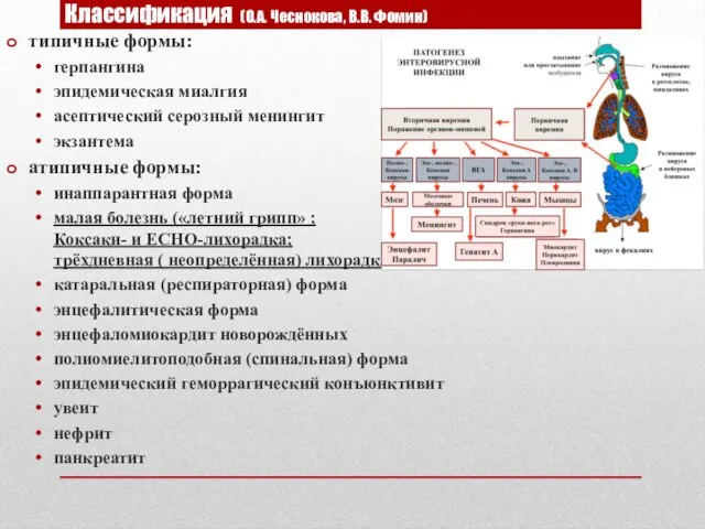 Классификация (О.А. Чеснокова, В.В. Фомин) типичные формы: герпангина эпидемическая миалгия асептический