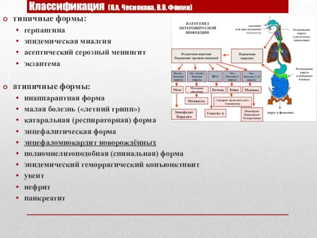 Классификация (О.А. Чеснокова, В.В. Фомин) типичные формы: герпангина эпидемическая миалгия асептический