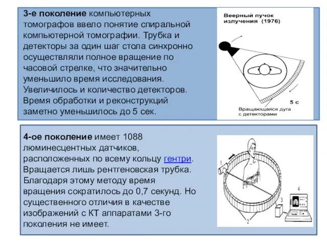 3-е поколение компьютерных томографов ввело понятие спиральной компьютерной томографии. Трубка и