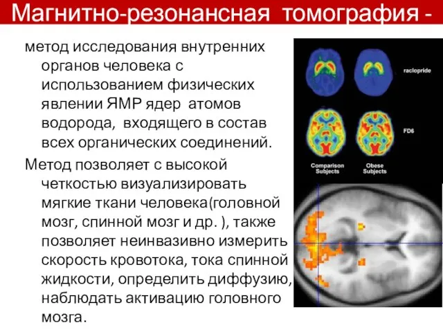 Магнитно-резонансная томография - метод исследования внутренних органов человека с использованием физических