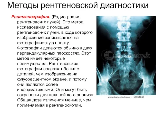 Методы рентгеновской диагностики Рентгенография. (Радиография рентгеновских лучей). Это метод исследования с