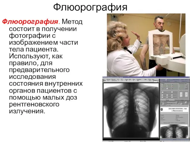 Флюорография Флюорография. Метод состоит в получении фотографии с изображением части тела