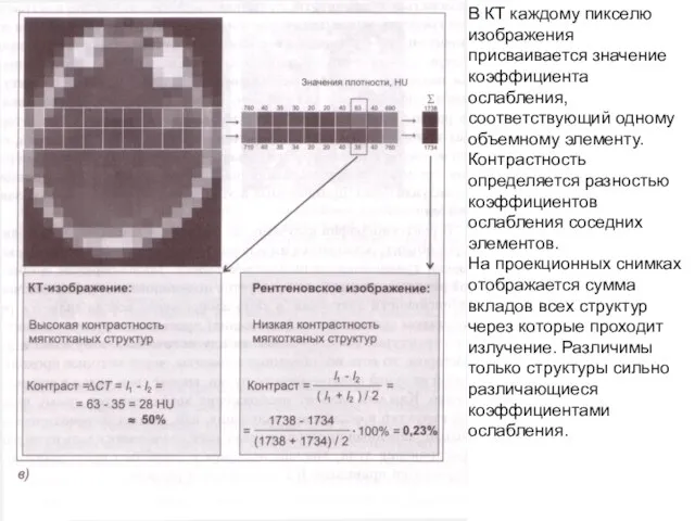 В КТ каждому пикселю изображения присваивается значение коэффициента ослабления, соответствующий одному