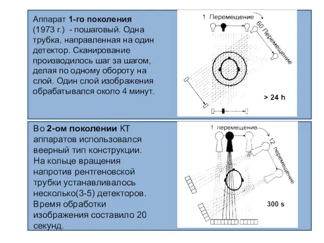 Аппарат 1-го поколения (1973 г.) - пошаговый. Одна трубка, направленная на
