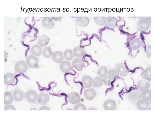 Trypanosoma sp. среди эритроцитов