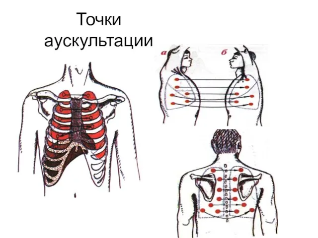 Точки аускультации