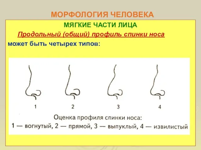 МОРФОЛОГИЯ ЧЕЛОВЕКА МЯГКИЕ ЧАСТИ ЛИЦА Продольный (общий) профиль спинки носа может быть четырех типов: