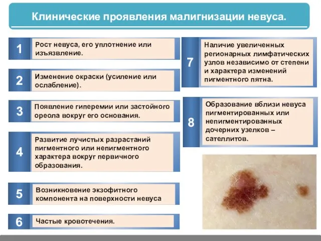 Рост невуса, его уплотнение или изъязвление. Изменение окраски (усиление или ослабление).