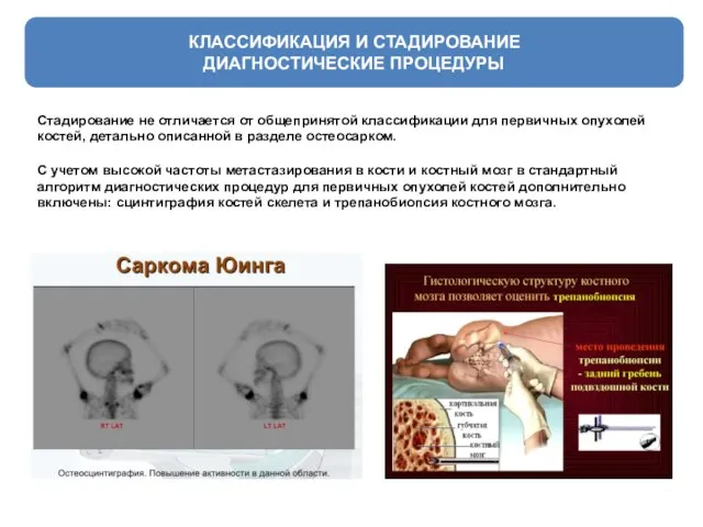 КЛАССИФИКАЦИЯ И СТАДИРОВАНИЕ ДИАГНОСТИЧЕСКИЕ ПРОЦЕДУРЫ Стадирование не отличается от общепринятой классификации