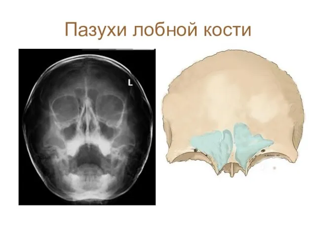 Пазухи лобной кости