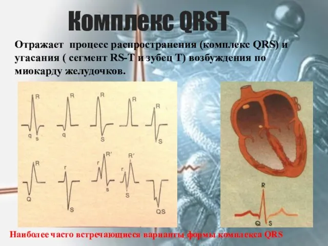 Комплекс QRSТ Отражает процесс распространения (комплекс QRS) и угасания ( сегмент