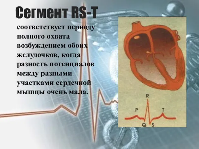 Сегмент RS-T соответствует периоду полного охвата возбуждением обоих желудочков, когда разность