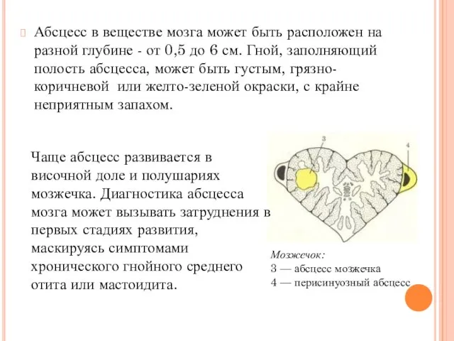 Абсцесс в веществе мозга может быть расположен на разной глубине -