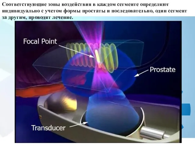 Соответствующие зоны воздействия в каждом сегменте определяют индивидуально с учетом формы