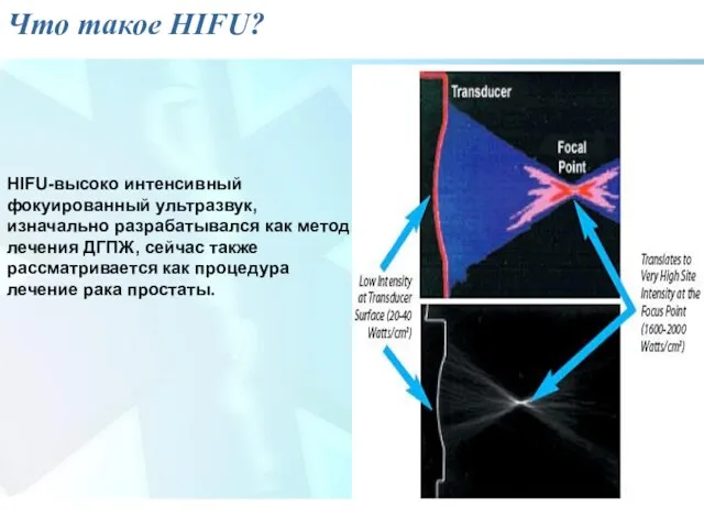 Что такое HIFU? HIFU-высоко интенсивный фокуированный ультразвук, изначально разрабатывался как метод