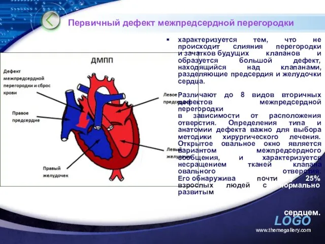 www.themegallery.com Первичный дефект межпредсердной перегородки характеризуется тем, что не происходит слияния