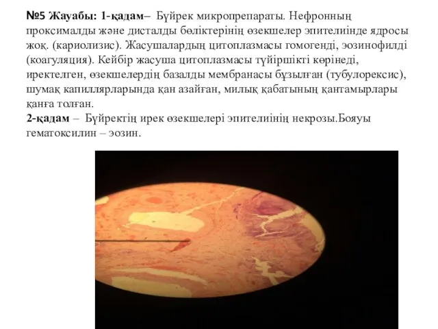 №5 Жауабы: 1-қадам– Бүйрек микропрепараты. Нефронның проксималды және дисталды бөліктерінің өзекшелер