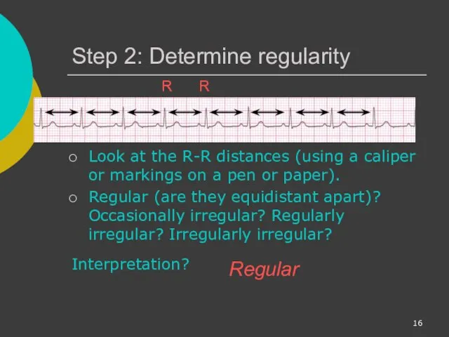 Step 2: Determine regularity Look at the R-R distances (using a