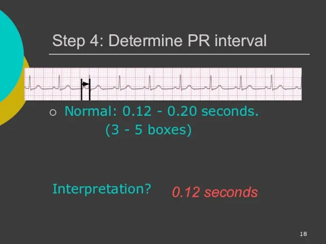 Step 4: Determine PR interval Normal: 0.12 - 0.20 seconds. (3