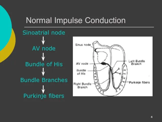 Normal Impulse Conduction Sinoatrial node AV node Bundle of His Bundle Branches Purkinje fibers