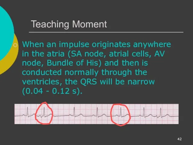 Teaching Moment When an impulse originates anywhere in the atria (SA