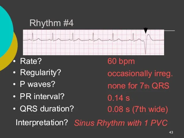 Rhythm #4 60 bpm Rate? Regularity? occasionally irreg. none for 7th