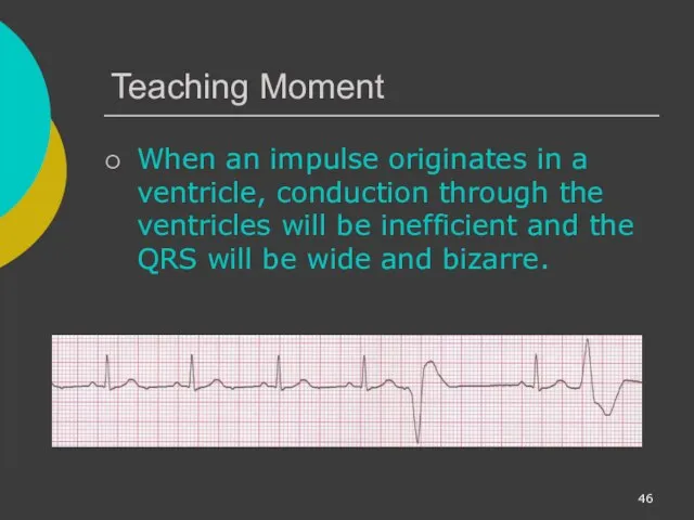 Teaching Moment When an impulse originates in a ventricle, conduction through