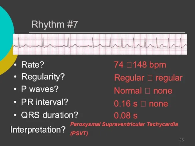 Rhythm #7 74 ?148 bpm Rate? Regularity? Regular ? regular Normal