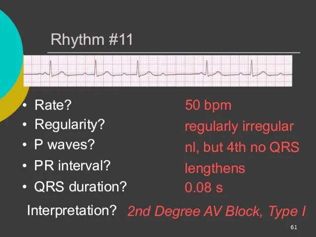 Rhythm #11 50 bpm Rate? Regularity? regularly irregular nl, but 4th