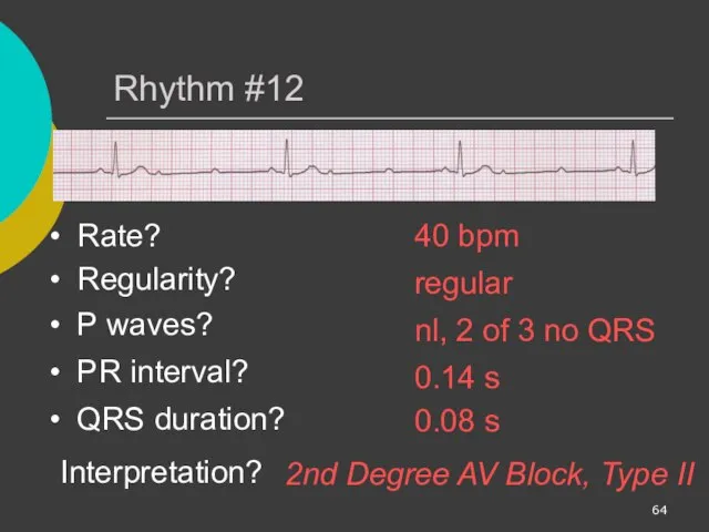 Rhythm #12 40 bpm Rate? Regularity? regular nl, 2 of 3