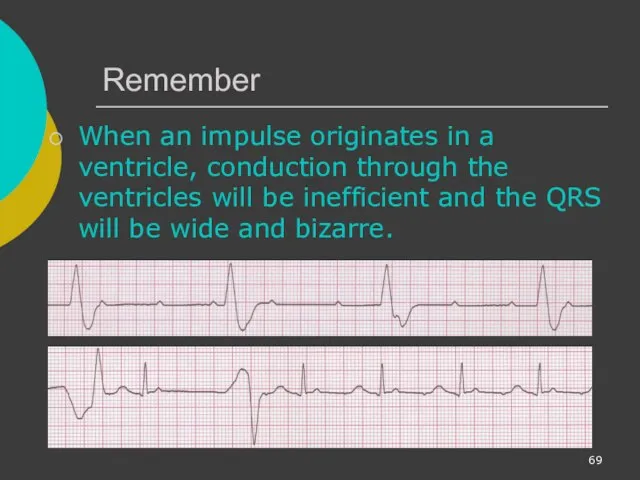 Remember When an impulse originates in a ventricle, conduction through the